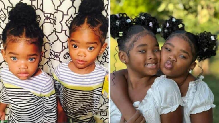 Le gemelle diventate famose in tutto il mondo per i loro fantastici