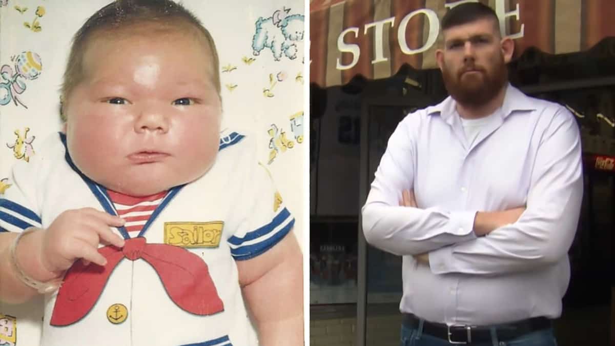 Questo bambino ha fatto notizia nel 1983 per la sue dimensioni, pesava 8 kg