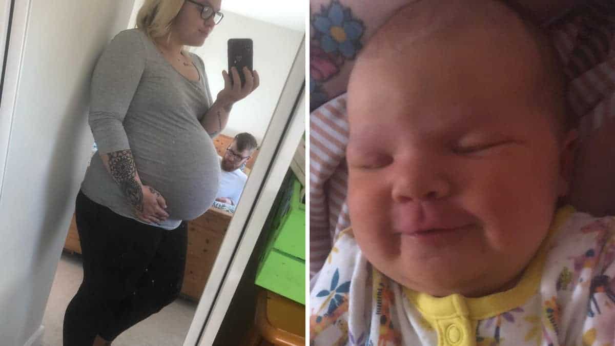 Donna partorisce un bambino enorme con la testa grande quanto un melone